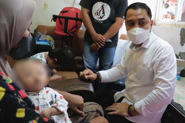 Kunjungi Anak Penderita Hidrosefalus, Wali Kota Eri Cahyadi Beri Bantuan Kesehatan